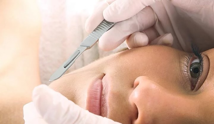 Dermaplaning image